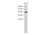 Western Blot analysis of Mouse liver using GCK Polyclonal Antibody at dilution of 1:1000