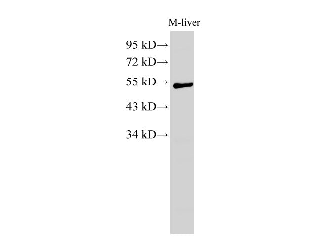 Western Blot analysis of Mouse liver using GCK Polyclonal Antibody at dilution of 1:1000