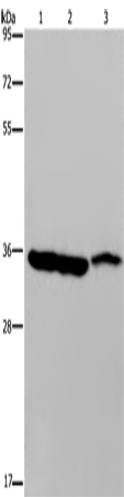 Anti-Human/Mouse/Rat MDH1 Antibody - ABMIUM
