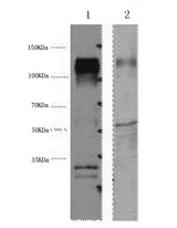 Western Blot analysis of 1) Hela, 2) Mouse brain using ERBB2 Monoclonal Antibody at dilution of 1:4000.