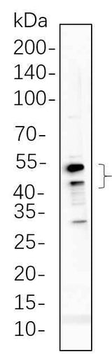 Anti-Human/Mouse/Rat GSK3 α, β Antibody [B591]