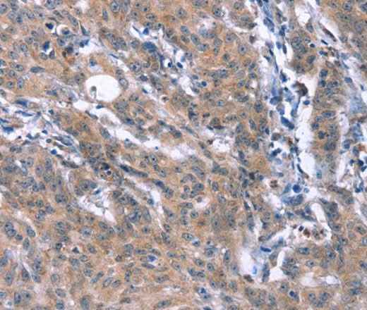 Anti-Human/Mouse ESPL1 Antibody - ABMIUM