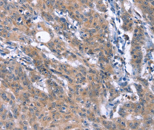 Anti-Human/Mouse ESPL1 Antibody - ABMIUM