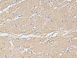 Immunohistochemistry of paraffin-embedded Human brain tissue using TAGLN3 Polyclonal Antibody at dilution of 1:70(×200)