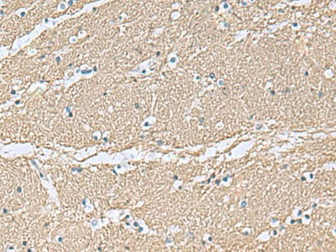 Immunohistochemistry of paraffin-embedded Human brain tissue using TAGLN3 Polyclonal Antibody at dilution of 1:70(×200)