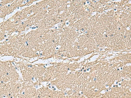 Immunohistochemistry of paraffin-embedded Human brain tissue using TAGLN3 Polyclonal Antibody at dilution of 1:70(×200)