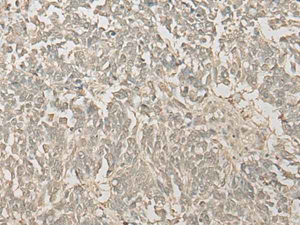 Anti-Human/Mouse/Rat FYTTD1 Antibody