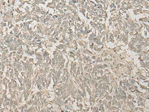 Anti-Human/Mouse/Rat FYTTD1 Antibody
