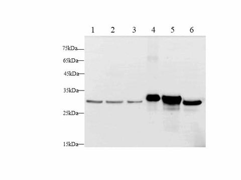 Western blot with Lgals3 Polyclonal antibody at dilution of 1:500.lane 1: Hela whole cell lysate, lane 2:MCF-7 whole cell lysate, lane 3:A431 whole cell lysate,lane 4:RAW264.7 whole cell lysate,lane 5:NIH/3T3 whole cell lysate,lane 6: C6 whole cell lysate