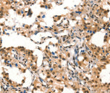 Anti-Human/Mouse CUL4B Antibody - ABMIUM