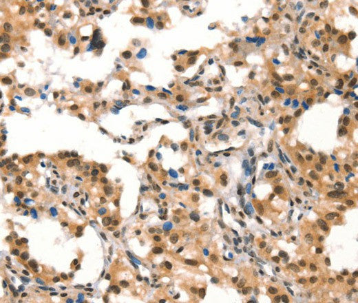 Anti-Human/Mouse CUL4B Antibody - ABMIUM