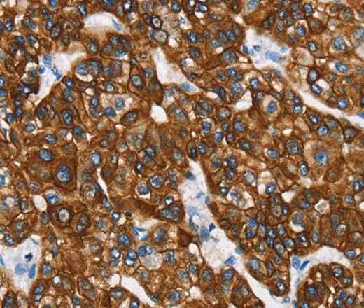 Anti-Human/Mouse/Rat CK-8 Antibody
