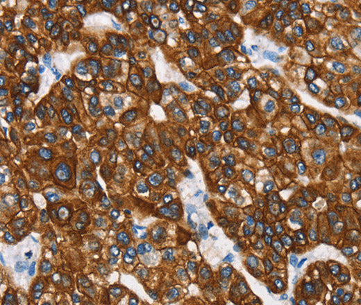 Anti-Human/Mouse/Rat CK-8 Antibody - ABMIUM