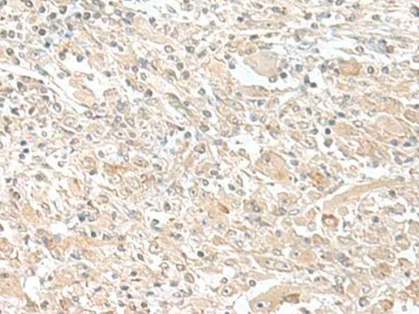 Anti-Human/Mouse SMS Antibody