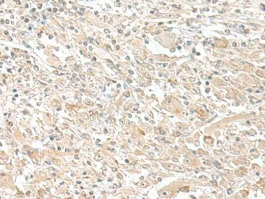 Anti-Human/Mouse SMS Antibody