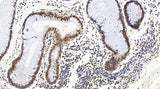Immunohistochemistry analysis of paraffin-embedded human colon using MAP2K1 Polyclonal Antibody at dilution of 1:100.