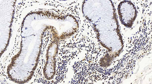 Immunohistochemistry analysis of paraffin-embedded human colon using MAP2K1 Polyclonal Antibody at dilution of 1:100.