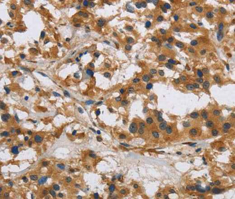 Anti-Human IL17RB Antibody