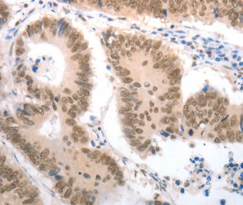 Anti-Human RAD52 Antibody - ABMIUM
