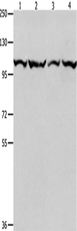 Anti-Human/Mouse MCM3 Antibody - ABMIUM