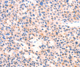 Anti-Human APBA2 Antibody - ABMIUM