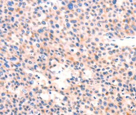 Anti-Human APBA2 Antibody