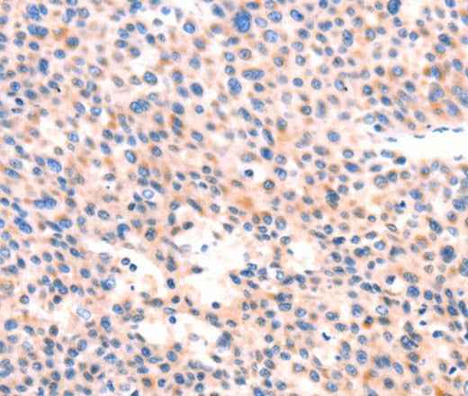 Anti-Human APBA2 Antibody