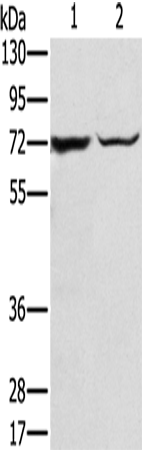 Anti-Human/Mouse SLC25A13 Antibody - ABMIUM