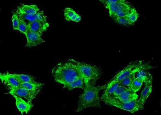 Anti-Human CD46 Antibody [B168] - ABMIUM