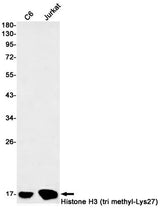 Western blot detection of Histone H3 (tri methyl-Lys27) in C6,Jurkat cell lysates using Histone H3 (tri methyl-Lys27) Rabbit mAb(1:1000 diluted).Predicted band size:15kDa.Observed band size:15kDa.