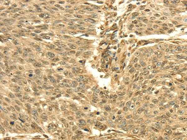 Anti-Human/Mouse/Rat SEPT2 Antibody