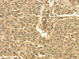Anti-Human/Mouse/Rat SEPT2 Antibody - ABMIUM