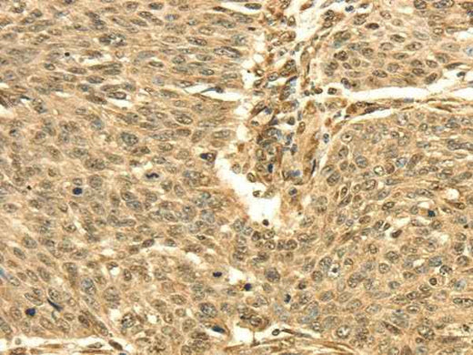 Anti-Human/Mouse/Rat SEPT2 Antibody