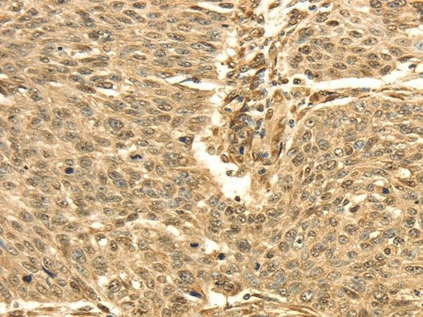 Anti-Human/Mouse/Rat SEPT2 Antibody - ABMIUM