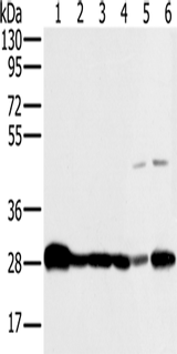 Anti-Human/Mouse NDUFS3 Antibody - ABMIUM