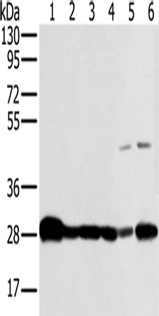 Anti-Human/Mouse NDUFS3 Antibody - ABMIUM