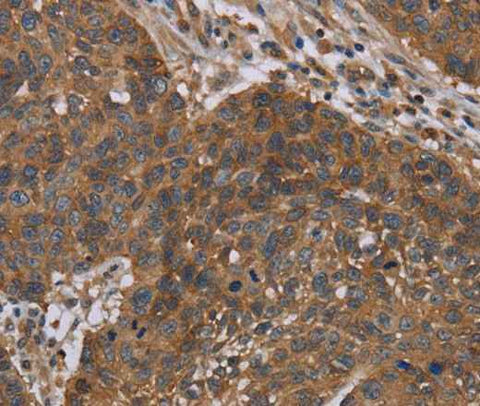 Anti-Human/Mouse/Rat OXTR Antibody
