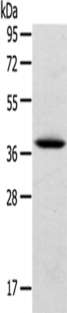 Anti-Human TPM2 Antibody - ABMIUM