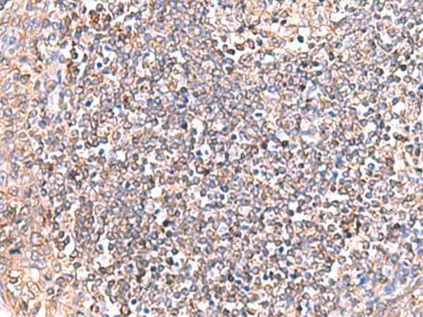 Anti-Human/Mouse/Rat GRIA2 Antibody