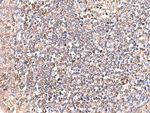 Immunohistochemistry of paraffin-embedded Human tonsil tissue using GRIA2 Polyclonal Antibody at dilution of 1:50(×200)