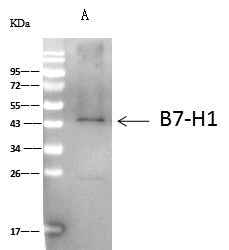 Anti-Human CD274 Antibody [A1002] - ABMIUM