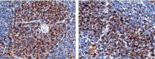 Anti-Mouse CD4 Antibody [B411] - ABMIUM