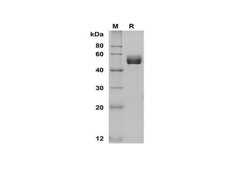 SDS-PAGE analysis of Human CD63 proteins, 2 μg/lane of Recombinant Human CD63 proteins, was resolved with SDS-PAGE under reducing conditions, showing bands at 49 kDa.