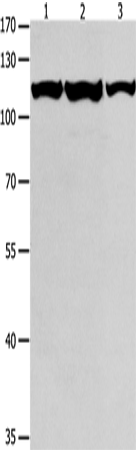 Anti-Human/Mouse MCM3 Antibody - ABMIUM