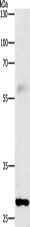Anti-Human/Mouse/Rat FGF2 Antibody - ABMIUM