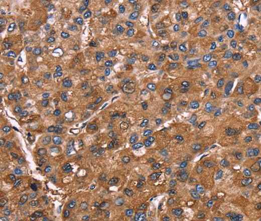 Anti-Human/Rat ELP2 Antibody