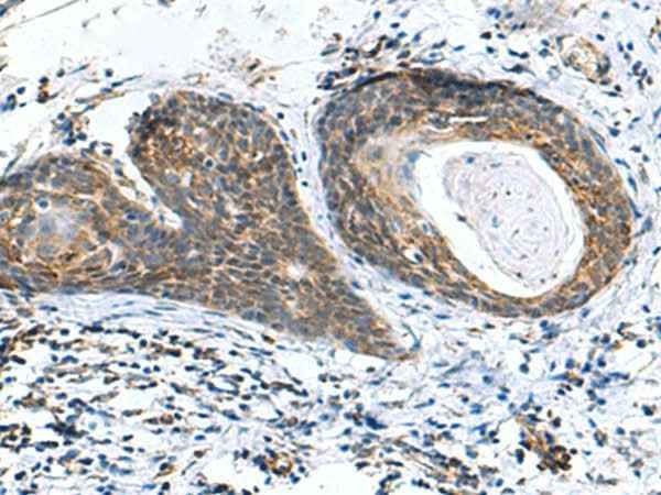Anti-Human/Mouse AP1S3 Antibody