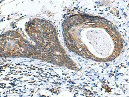 Anti-Human/Mouse AP1S3 Antibody