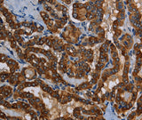 Anti-Human PIDD1 Antibody - ABMIUM