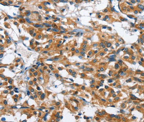 Anti-Human BPI Antibody - ABMIUM